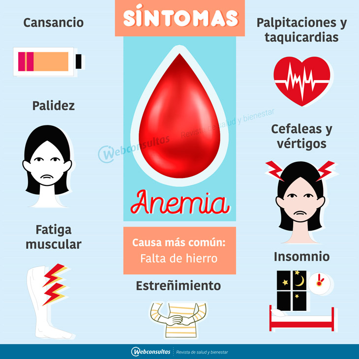 Síntomas de anemia - Salud al día