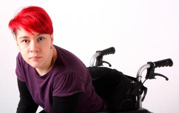 Evolución de la esclerosis múltiple Evolución de la esclerosis múltiple en el paciente