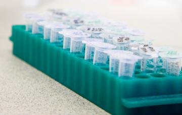 Prevención de la distrofia muscular de Duchenne Diagnístico genético para prevenir la distrofia muscular de Duchenne