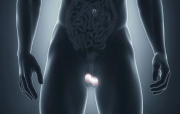 Causas del cáncer testicular Causas del cáncer de testículo