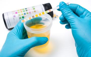Diagnóstico de una infección urinaria Diagnóstico de una infección urinaria