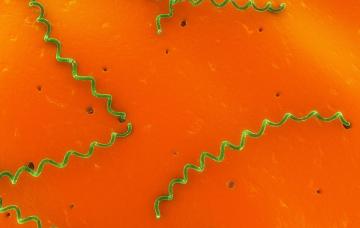 Leptospirosis Leptospirosis