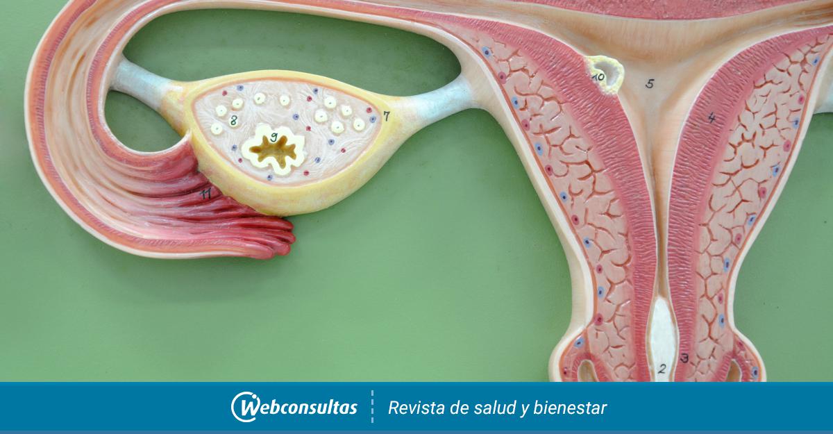 Cáncer de ovario, qué es - Salud al día