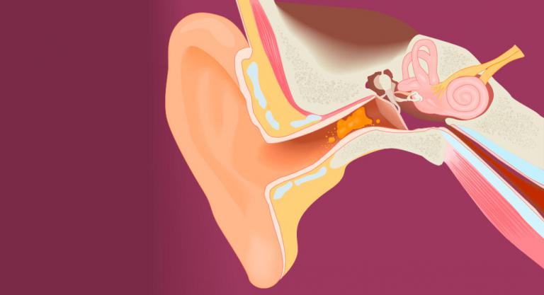 Esta es la manera correcta de limpiar tus oídos sin hacerles daño –  Enséñame de Ciencia
