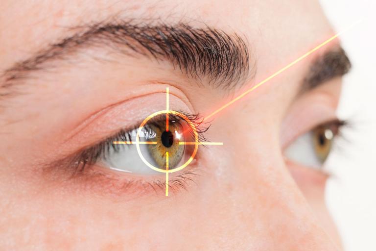 Hombre sometiéndose a una cirugía laser para cambiar el color de sus ojos