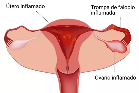 Dibujo de aparato genital femenino