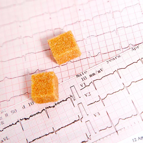 Complicaciones cardiovasculares asociadas a la diabetes