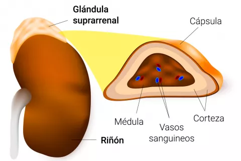 Ilustración de las causas de la enfermedad de Addison