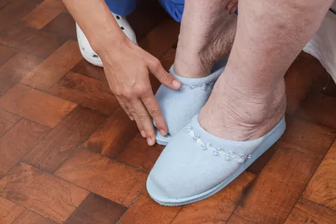 Zapatillas cómodas para las piernas hinchadas