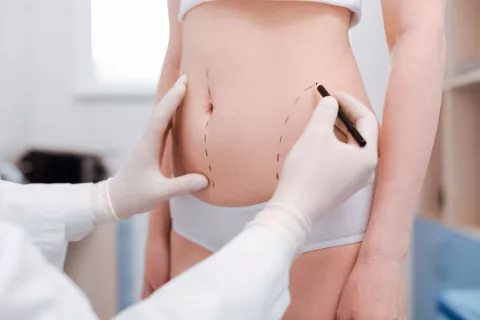 Médico evaluando el proceso de una lipoescutura