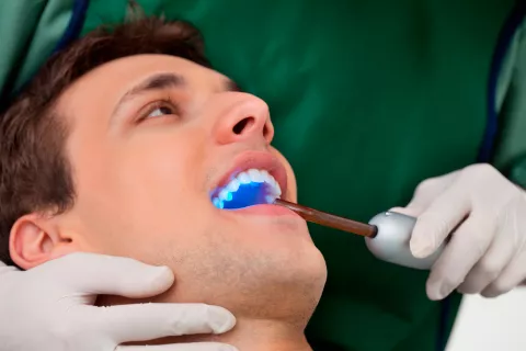 Precauciones en el blanqueamiento dental