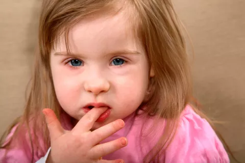 Salud en el niño con síndrome de Down