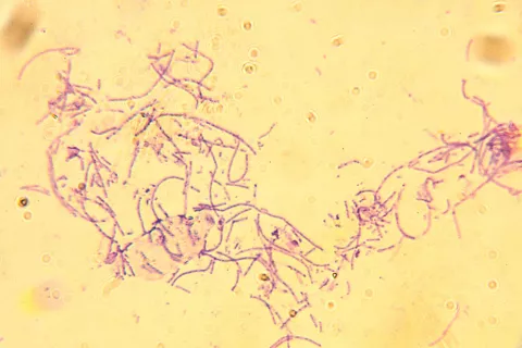 Bacillus anthracis