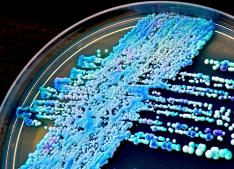 Causas de candidiasis