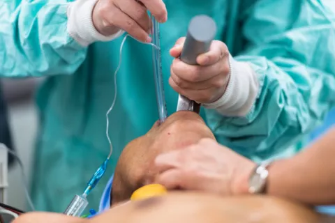 Médico realizando una CPRE a un paciente