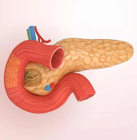 Diagnóstico de los tumores exocrinos de páncreas