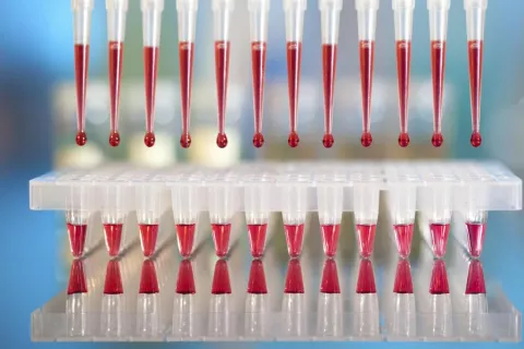 Resultados de la biopsia de médula ósea