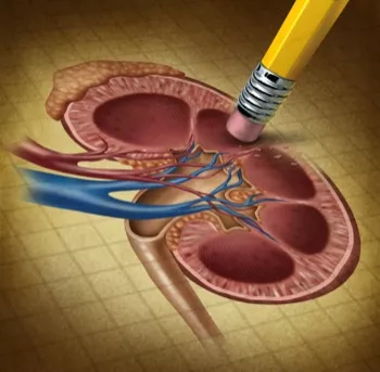 Tratamiento del cáncer de riñón