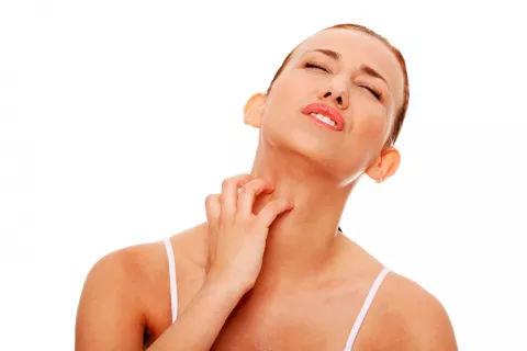 Mujer con urticaria en el cuello