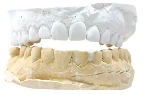 Piezas dentales al cumplir los 40 años