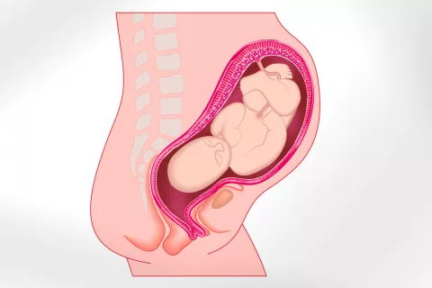 El cuello uterino ayuda a predecir un parto prematuro