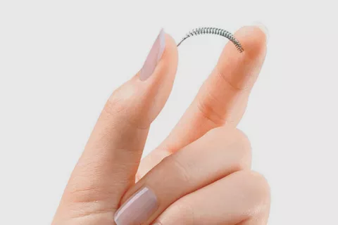 Método anticonceptivo permanente essure