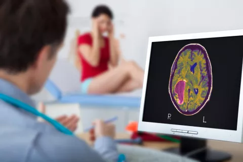 Paciente con tumor en el cerebro