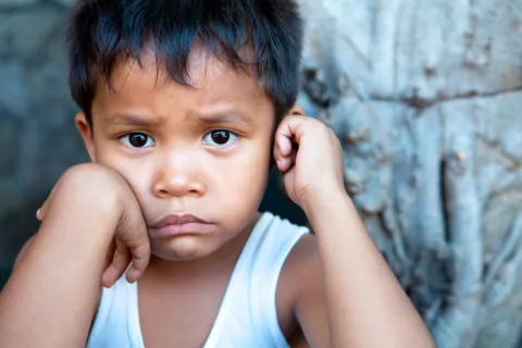 Niño afectado de leishmaniasis