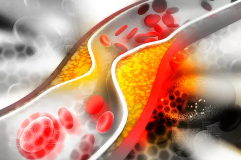 Molécula de arteriosclerosis