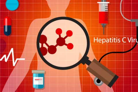 Nueva terapia, efectiva en pacientes con VHC e IRC