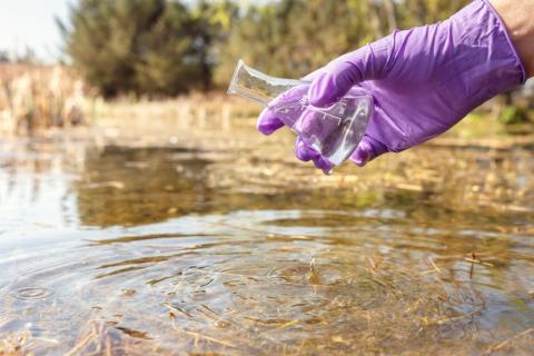 Toma de muestra de agua potable por sospecha de cólera