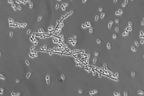 Hongo candidiasis