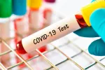 Test de Covid-19