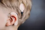 Implante coclear Implante coclear en un niño