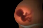 Pérdida de bienestar fetal, cómo detectarlo Sufrimiento fetal: causas, riesgos y cómo detectarlo