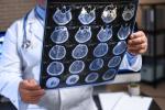 Médico estudia imágenes del cerebro