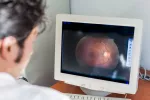 Ozempic eleva el riesgo de daños en el nervio óptico de pacientes diabéticos Un oftalmólogo mirando una tomografía de retina en un monitor de ordenador