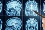 Cómo gestiona la información el cerebro Escáner de un cerebro