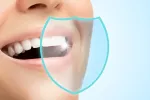 Mujer sonríe mostrando sus dientes blancos y sin caries Dentadura sana de una mujer con dibujo de escudo protector sobre ella