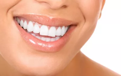 Blancorexia Mujer sonriendo con dientes muy blancos