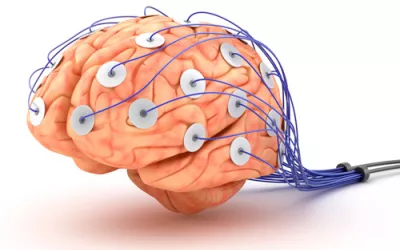 Estudio de potenciales evocados Estudio de potenciales evocados