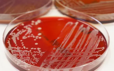Tinción de Gram Tinción de Gram en el laboratorio