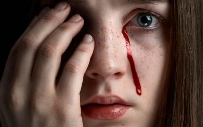 Hemolacria: ¿Es posible llorar sangre?