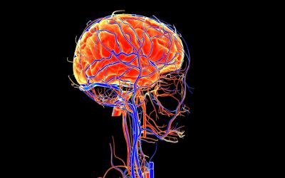 Flujo sanguíneo cerebral alterado en el alzhéimer en fases iniciales