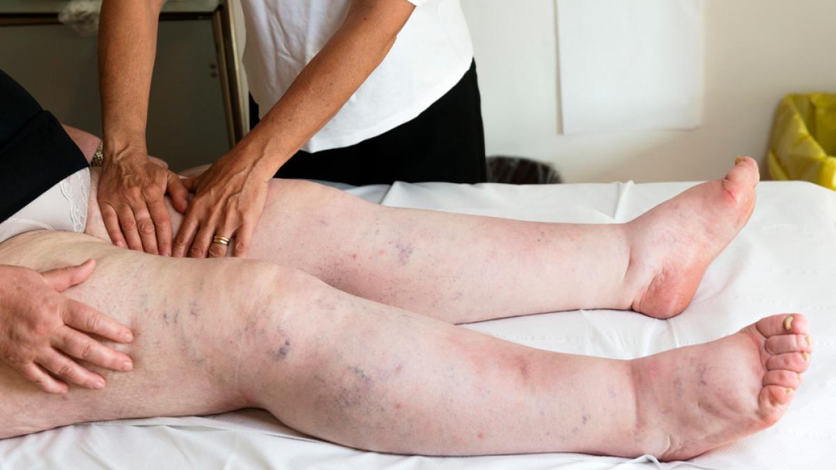 Tratamiento manual en piernas y pies con masajes