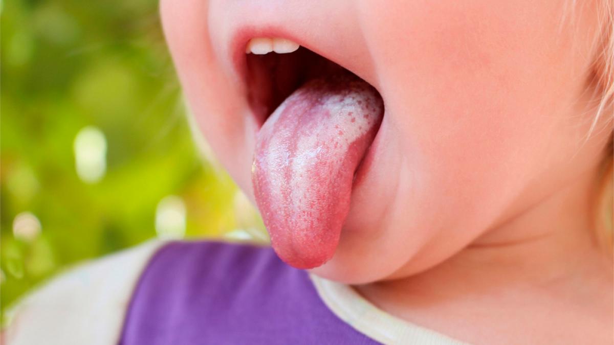 Limpieza de la lengua del bebé recién nacido